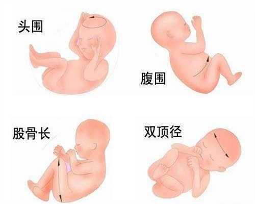 目前广州高鹰代孕妇及广州高鹰代孕哺乳期碘营养现状及