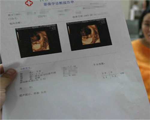 武汉市哪里能找到高鹰代孕妈妈：分娩前的准备准爸