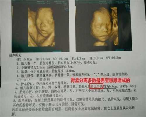 武汉市哪里能找到高鹰代孕妈妈：分娩前的准备准爸