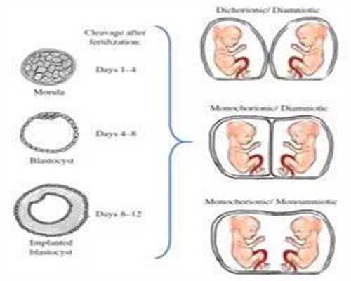 佛山高鹰代孕：24周，胎儿和妇有哪些变化，这些变化