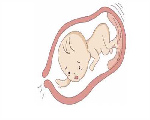 香港助孕药：1个月胎儿发育标准