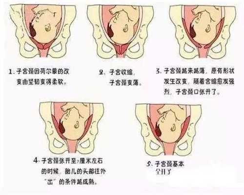 广州传承助孕中心怎样：不要食用“新奇”、“