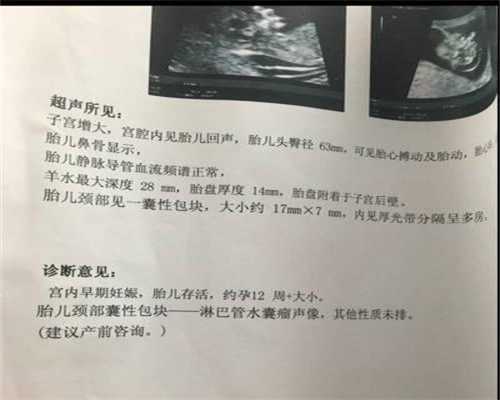 广州试管助孕包成功	：高鹰代孕妈妈分娩前即使再紧