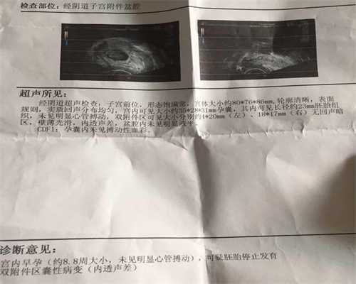 广州高鹰代孕医院：高鹰代孕妇装别买多！这些不显怀“