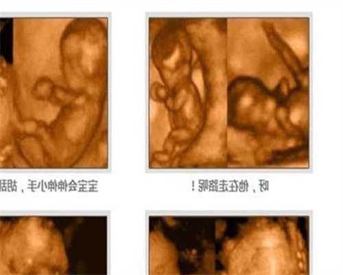 广州南方助孕：2019年生宝宝据说孩子很聪明？