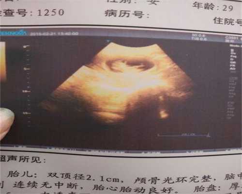 广州世纪助孕公司价格表：二胎注意事项：第2次