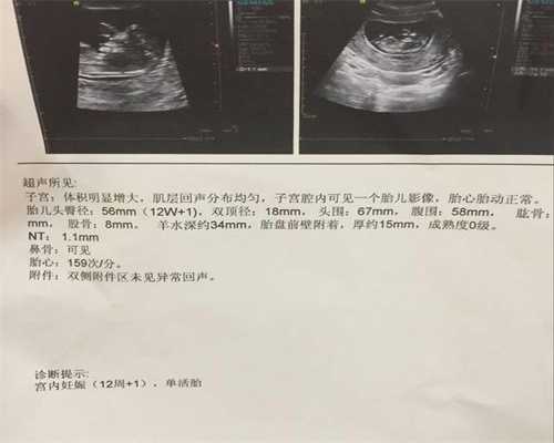广州传承助孕中心骗：每天要多吃3种食物，排毒