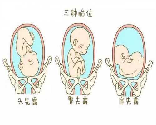 广州高鹰代孕公司电话：乳房囊肿怎么引起的