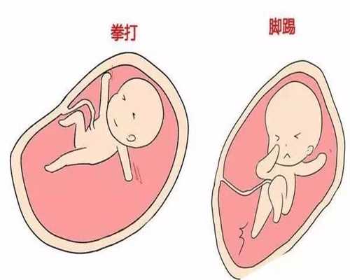 广州十月助孕：高鹰代孕初期不可以吃什么鱼