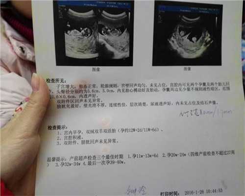 广州代孕赔偿_广州如何知道输卵管是否畅通_患有