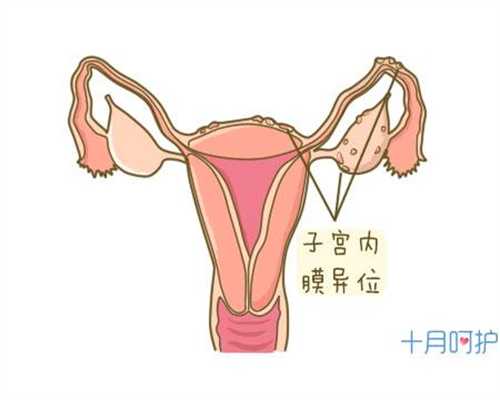 成功代孕方案，精子畸形会影响生育吗
