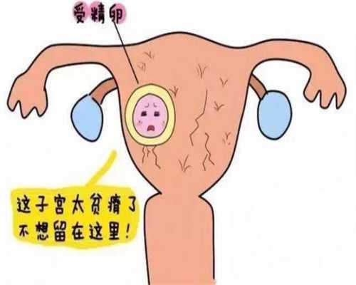 广州借卵生子孩子会像谁-广州东骏国际助孕中心