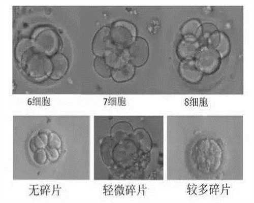 广州代孕产子公司合同#广州供卵有自己的基因吗