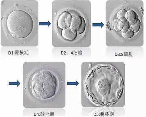 广州杭州试管助孕包成功多少钱，广州成都代孕
